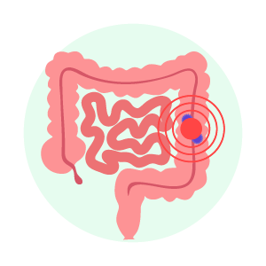 Colorectal cancer