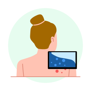 Skin cancer